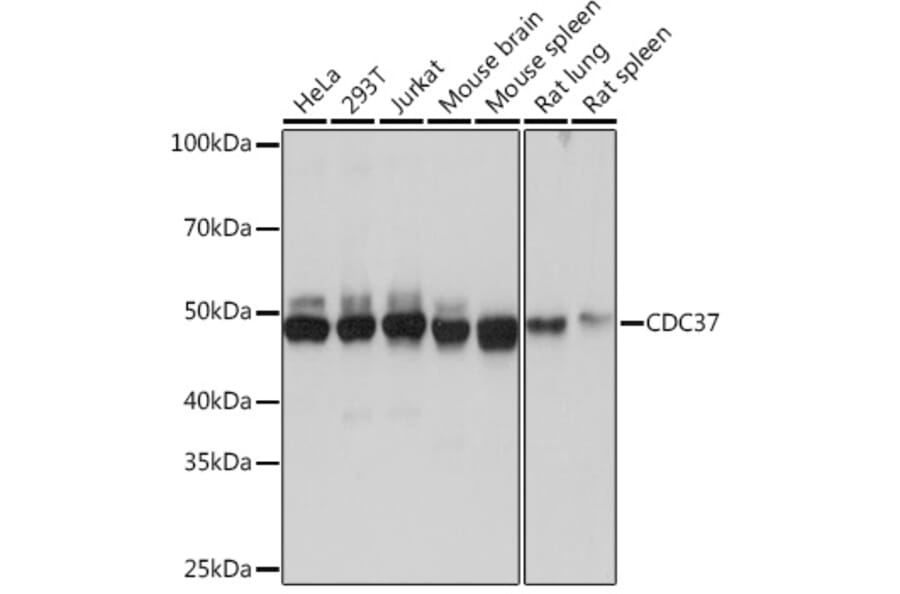 Western Blot - Anti-Cdc37 Antibody [ARC1040] (A307958) - Antibodies.com