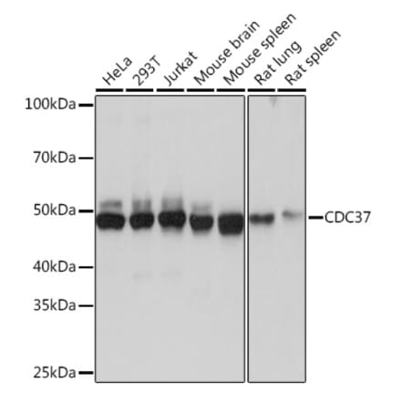 Western Blot - Anti-Cdc37 Antibody [ARC1040] (A307958) - Antibodies.com