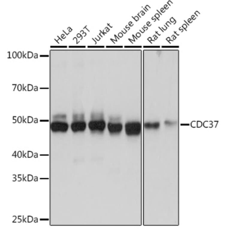 Western Blot - Anti-Cdc37 Antibody [ARC1040] (A307958) - Antibodies.com