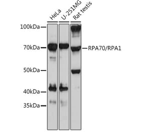 Western Blot - Anti-RPA70 Antibody [ARC0773] (A307959) - Antibodies.com