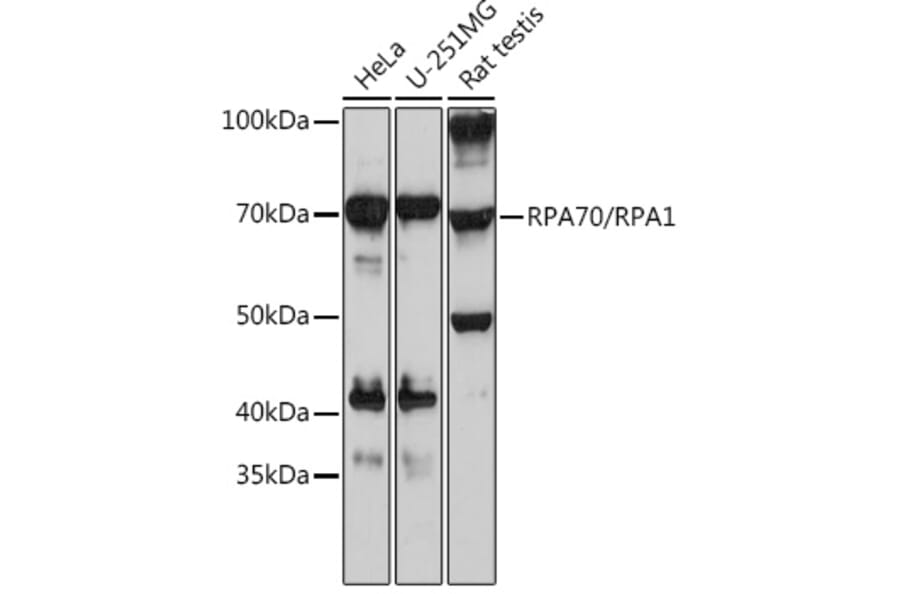 Western Blot - Anti-RPA70 Antibody [ARC0773] (A307959) - Antibodies.com