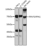 Western Blot - Anti-RPA70 Antibody [ARC0773] (A307959) - Antibodies.com