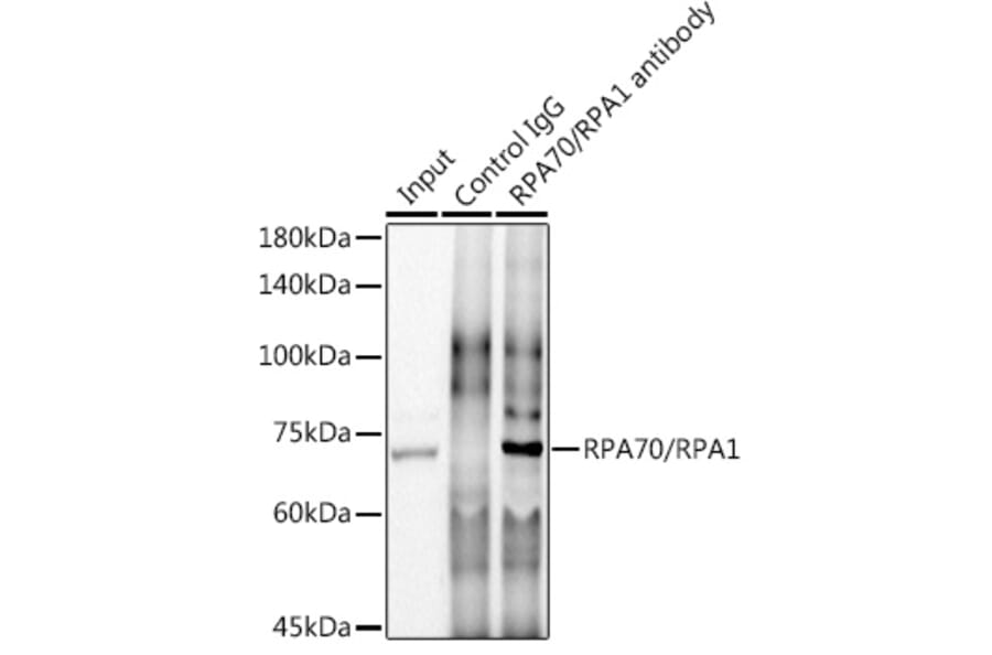 Western Blot - Anti-RPA70 Antibody [ARC0773] (A307959) - Antibodies.com