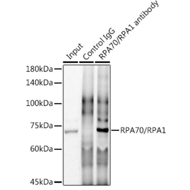 Western Blot - Anti-RPA70 Antibody [ARC0773] (A307959) - Antibodies.com