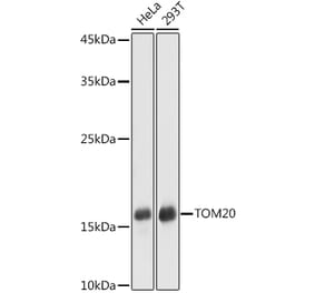 Western Blot - Anti-TOMM20 Antibody (A307960) - Antibodies.com