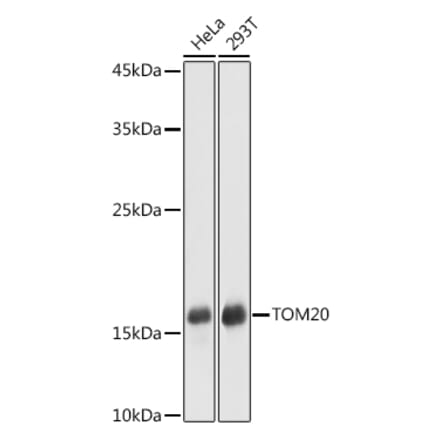 Western Blot - Anti-TOMM20 Antibody (A307960) - Antibodies.com