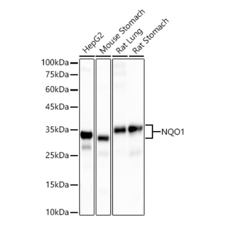 Western Blot - Anti-NQO1 Antibody [ARC56753] (A307961) - Antibodies.com