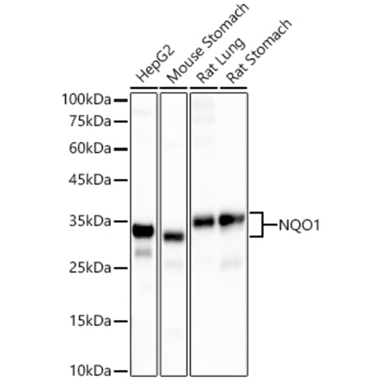 Western Blot - Anti-NQO1 Antibody [ARC56753] (A307961) - Antibodies.com