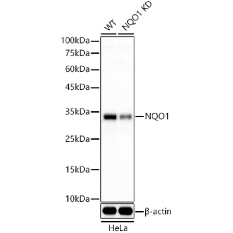 Western Blot - Anti-NQO1 Antibody [ARC56753] (A307961) - Antibodies.com