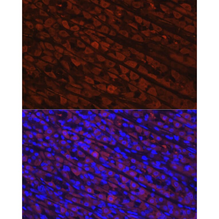 Immunohistochemistry - Anti-NQO1 Antibody [ARC56753] (A307961) - Antibodies.com