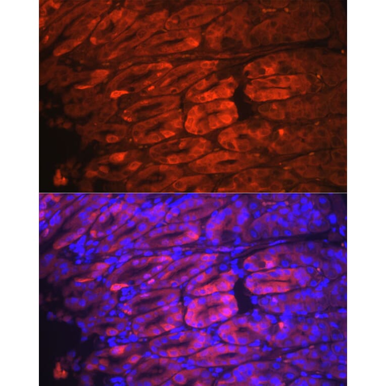Immunofluorescence - Anti-NQO1 Antibody [ARC56753] (A307961) - Antibodies.com