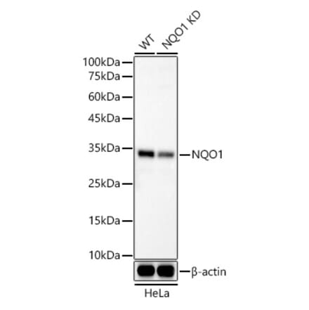 Western Blot - Anti-NQO1 Antibody [ARC56754] (A307963) - Antibodies.com