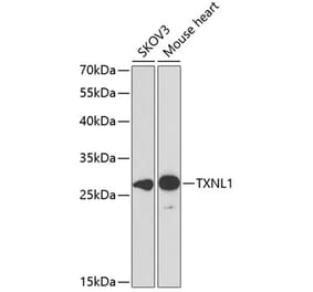 Western Blot - Anti-TXNL1 Antibody (A307964) - Antibodies.com