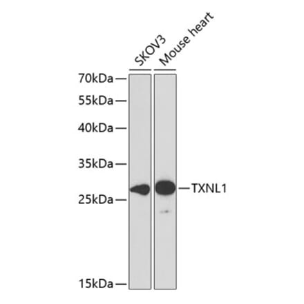 Western Blot - Anti-TXNL1 Antibody (A307964) - Antibodies.com