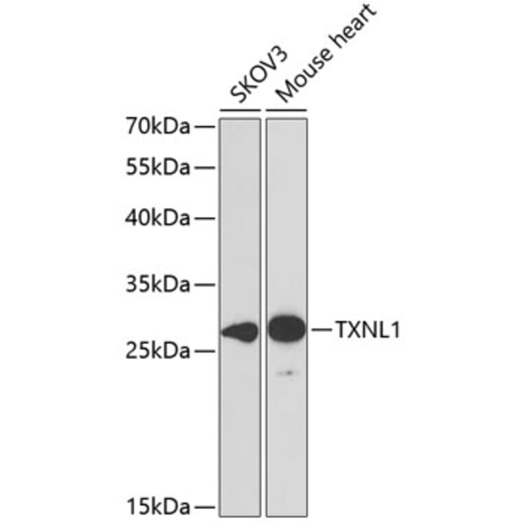 Western Blot - Anti-TXNL1 Antibody (A307964) - Antibodies.com