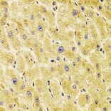 Immunohistochemistry - Anti-TXNL1 Antibody (A307964) - Antibodies.com