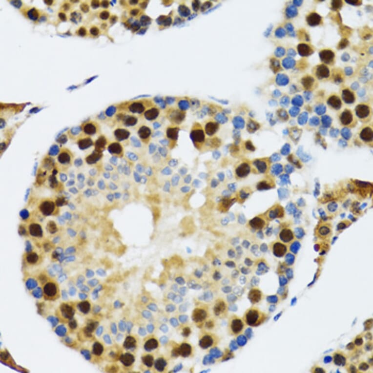 Immunohistochemistry - Anti-TXNL1 Antibody (A307964) - Antibodies.com