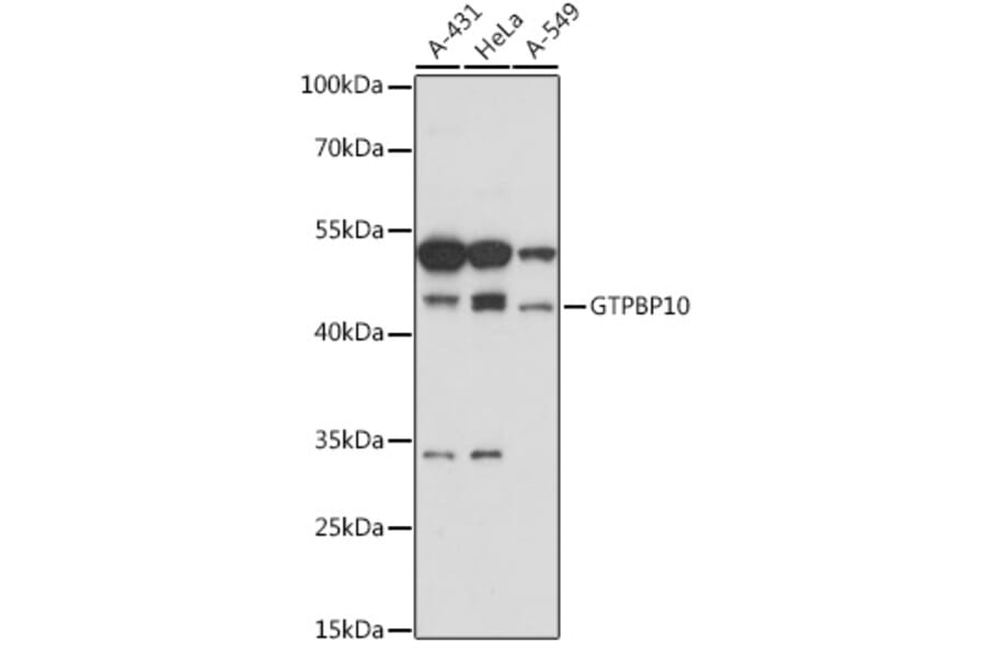 Western Blot - Anti-GTPBP10 Antibody (A307965) - Antibodies.com