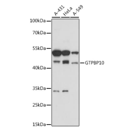 Western Blot - Anti-GTPBP10 Antibody (A307965) - Antibodies.com