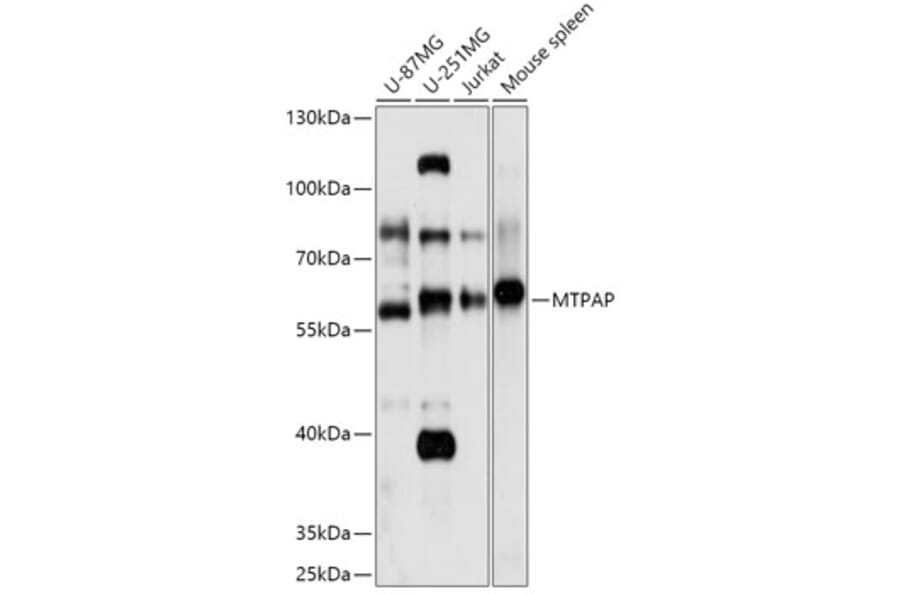 Western Blot - Anti-MTPAP Antibody (A307966) - Antibodies.com