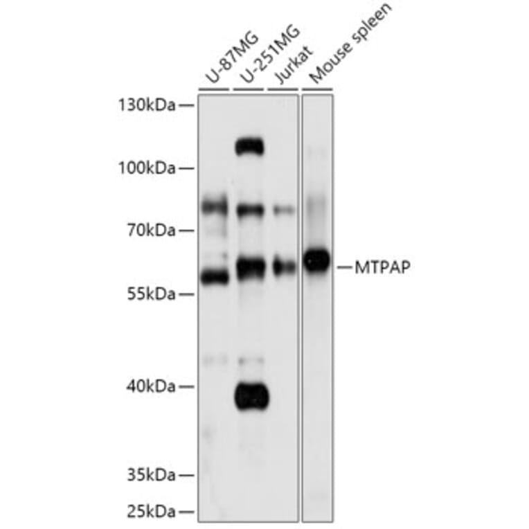 Western Blot - Anti-MTPAP Antibody (A307966) - Antibodies.com