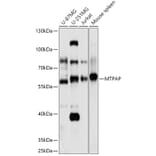 Western Blot - Anti-MTPAP Antibody (A307966) - Antibodies.com