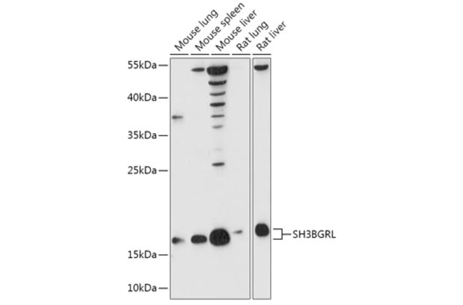 Western Blot - Anti-SH3BGRL Antibody (A307967) - Antibodies.com