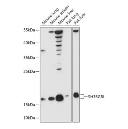 Western Blot - Anti-SH3BGRL Antibody (A307967) - Antibodies.com