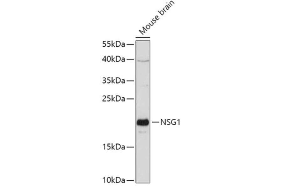 Western Blot - Anti-NSG1 Antibody (A307972) - Antibodies.com