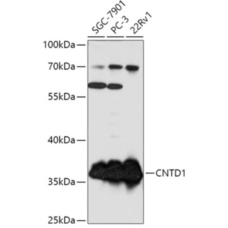 Western Blot - Anti-CNTD1 Antibody (A307974) - Antibodies.com