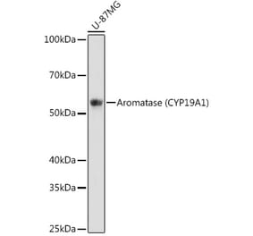 Western Blot - Anti-Aromatase Antibody [ARC0635] (A307975) - Antibodies.com