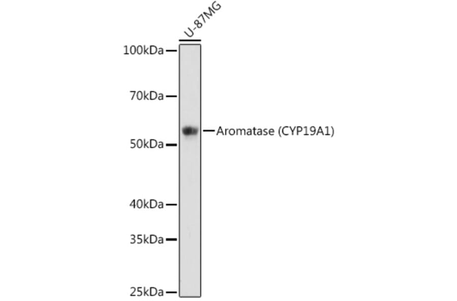 Western Blot - Anti-Aromatase Antibody [ARC0635] (A307975) - Antibodies.com