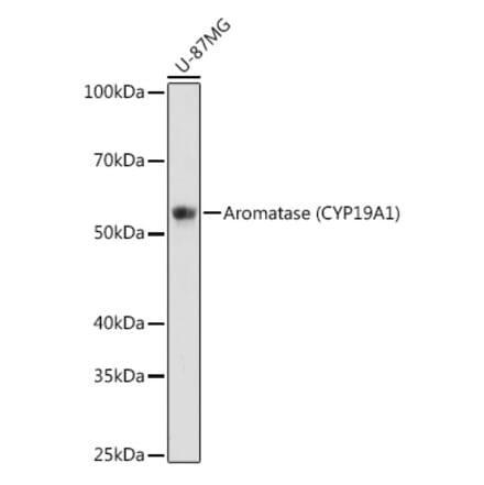 Western Blot - Anti-Aromatase Antibody [ARC0635] (A307975) - Antibodies.com