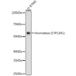 Western Blot - Anti-Aromatase Antibody [ARC0635] (A307975) - Antibodies.com