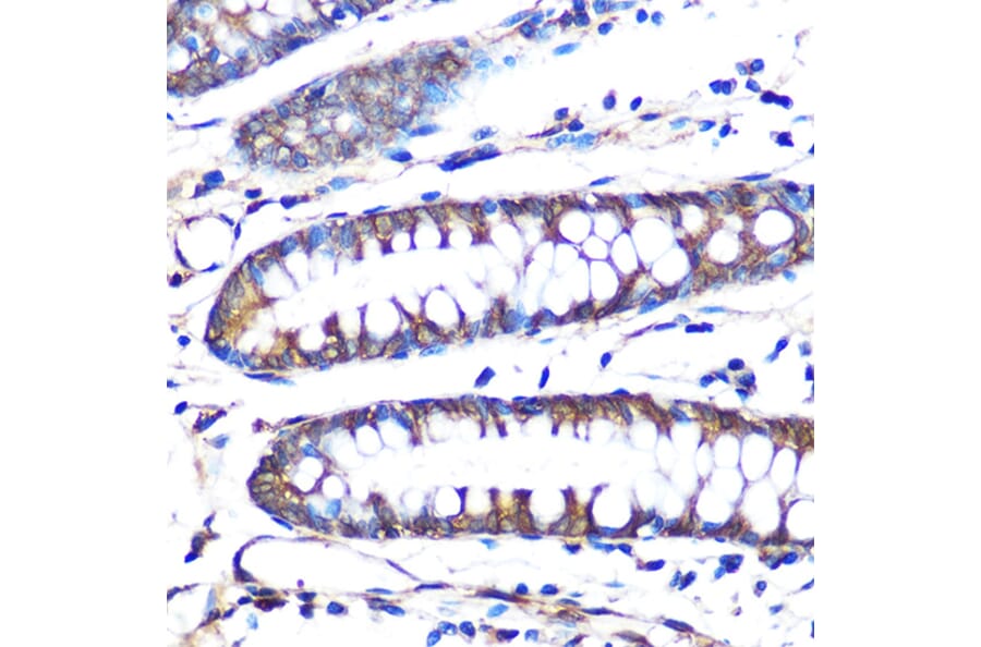 Immunohistochemistry - Anti-Aromatase Antibody [ARC0635] (A307975) - Antibodies.com