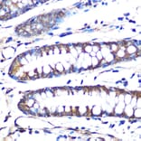 Immunohistochemistry - Anti-Aromatase Antibody [ARC0635] (A307975) - Antibodies.com