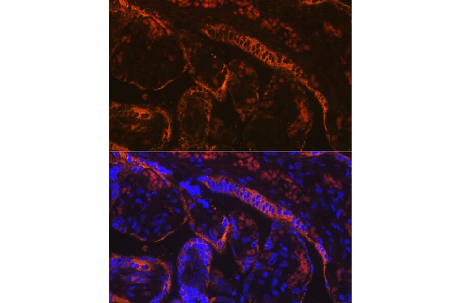 Immunofluorescence - Anti-Aromatase Antibody [ARC0635] (A307975) - Antibodies.com