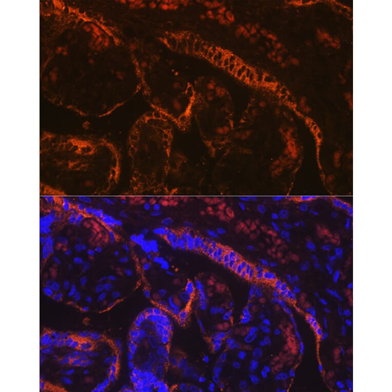 Immunofluorescence - Anti-Aromatase Antibody [ARC0635] (A307975) - Antibodies.com