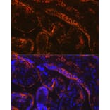 Immunofluorescence - Anti-Aromatase Antibody [ARC0635] (A307975) - Antibodies.com