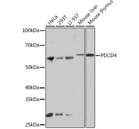 Western Blot - Anti-PDCD4 Antibody [ARC1398] (A307976) - Antibodies.com