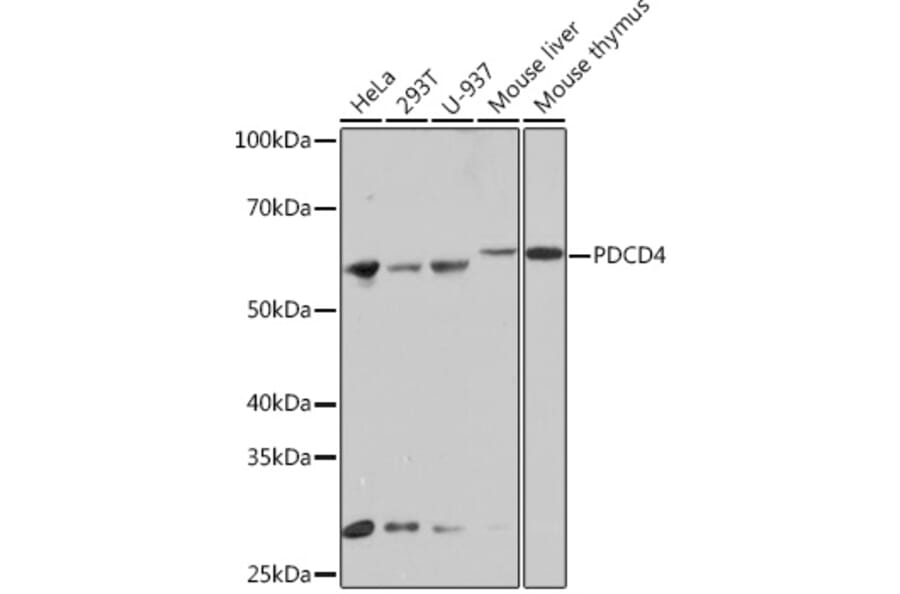 Western Blot - Anti-PDCD4 Antibody [ARC1398] (A307976) - Antibodies.com