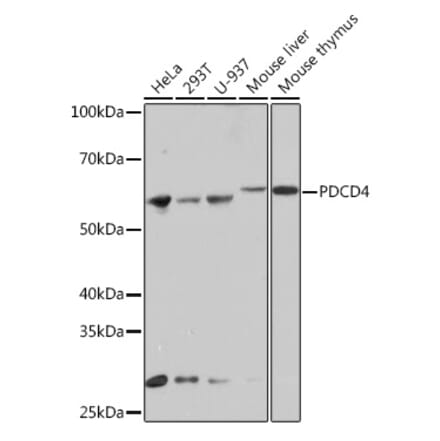 Western Blot - Anti-PDCD4 Antibody [ARC1398] (A307976) - Antibodies.com