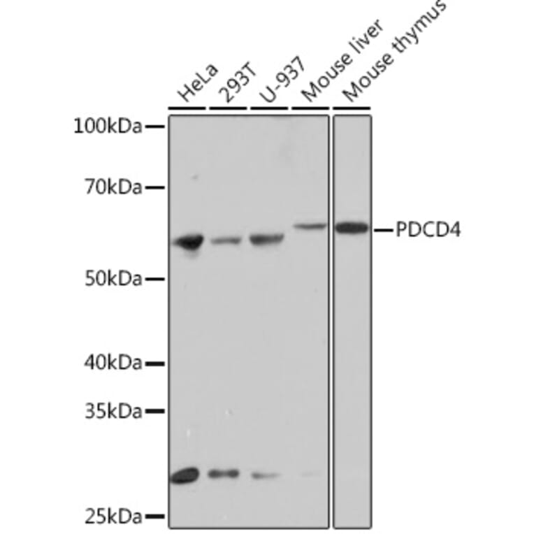 Western Blot - Anti-PDCD4 Antibody [ARC1398] (A307976) - Antibodies.com