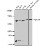 Western Blot - Anti-PDCD4 Antibody [ARC1398] (A307976) - Antibodies.com