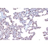 Immunohistochemistry - Anti-PDCD4 Antibody [ARC1398] (A307976) - Antibodies.com