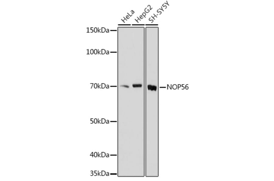 Western Blot - Anti-NOL5A Antibody (A307977) - Antibodies.com
