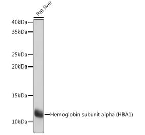 Western Blot - Anti-Hemoglobin subunit alpha Antibody [ARC1510] (A307978) - Antibodies.com