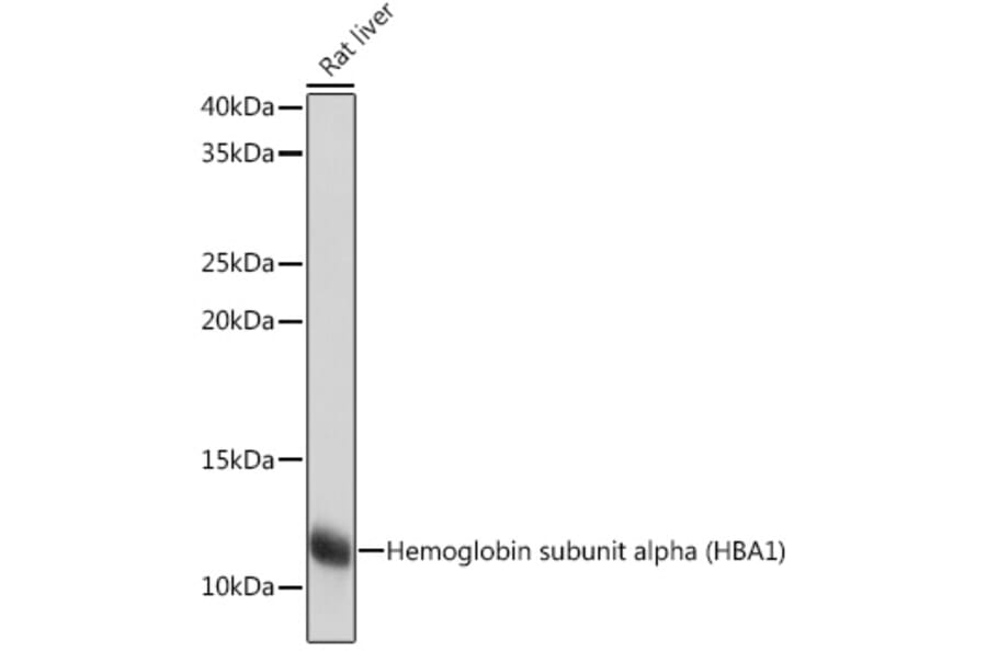 Western Blot - Anti-Hemoglobin subunit alpha Antibody [ARC1510] (A307978) - Antibodies.com