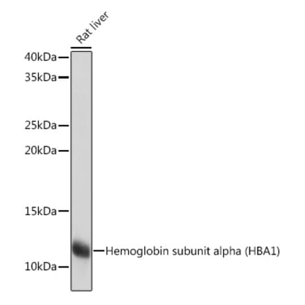 Western Blot - Anti-Hemoglobin subunit alpha Antibody [ARC1510] (A307978) - Antibodies.com