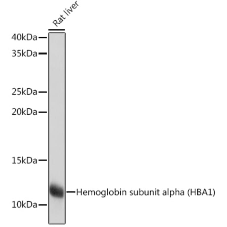 Western Blot - Anti-Hemoglobin subunit alpha Antibody [ARC1510] (A307978) - Antibodies.com